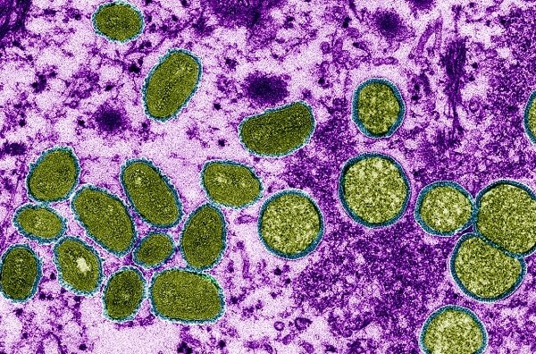 a microspe image of the monkeypox virus