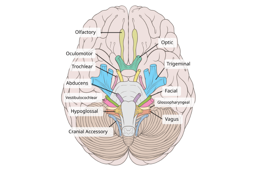 Migraines