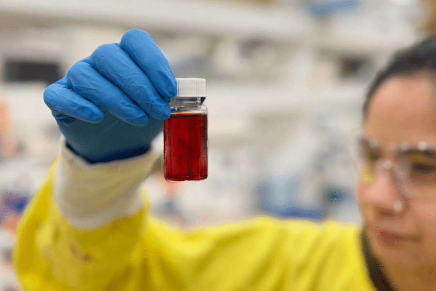 Detecting kidney damage